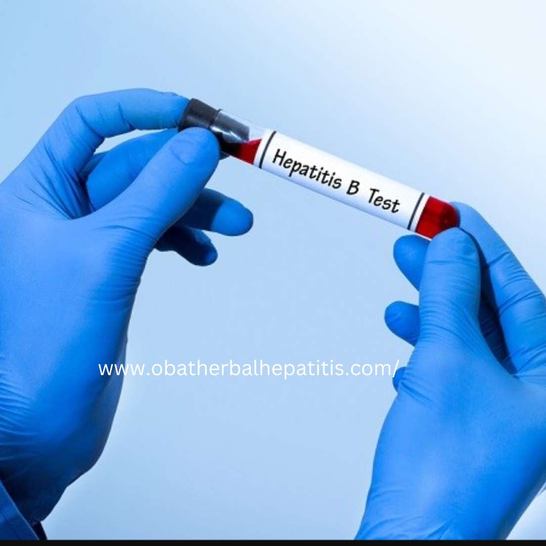 Prosedur Tes Hepatitis Pentingnya Deteksi Dini